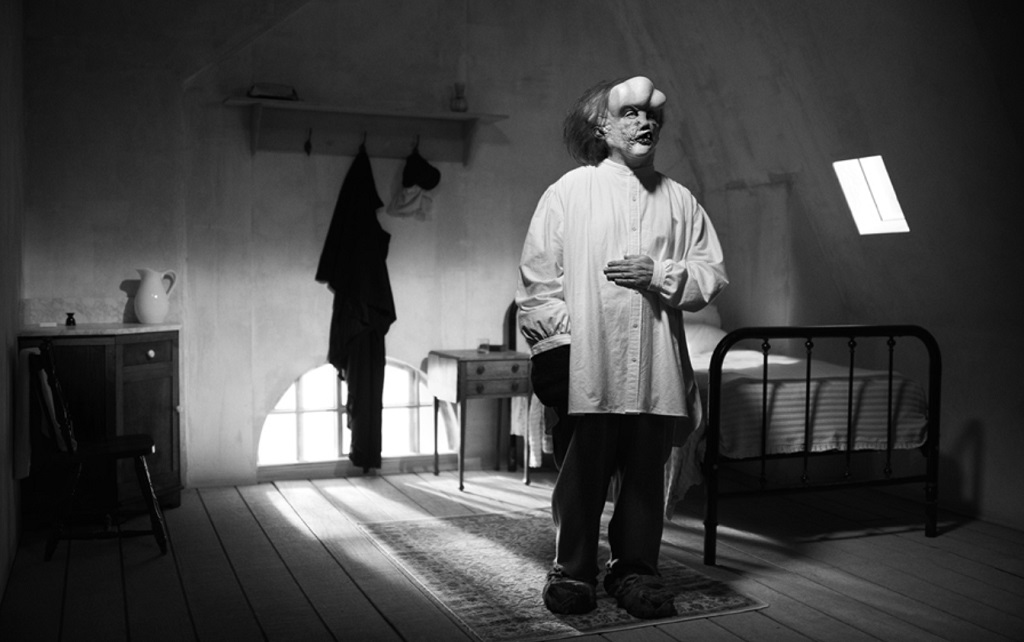 David Lynch, The Elephant Man